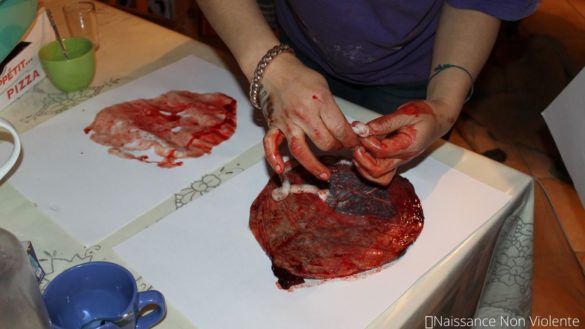 placenta